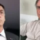 Bolsonaro passa por endoscopia e tera tratamento medico intensificado