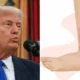 Donald Trump e diagnosticado com insuficiencia venosa cronica informa Casa