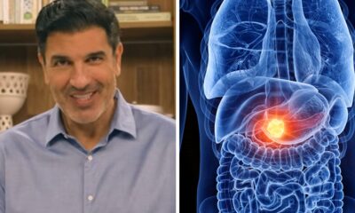 Esse foi o sintoma que Edu Guedes teve antes ser
