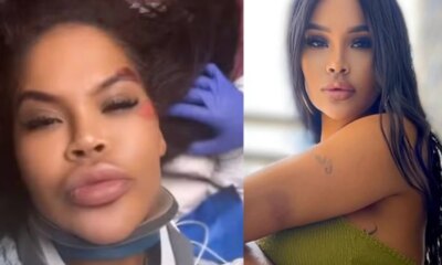 Ex Big Brother sofre grave acidente e desabafa do hospital ‘Fui