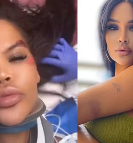 Ex Big Brother sofre grave acidente e desabafa do hospital ‘Fui