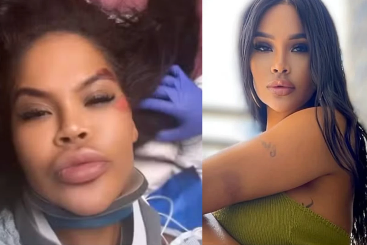 Ex Big Brother sofre grave acidente e desabafa do hospital ‘Fui