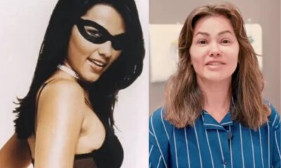 Ex Tiazinha precisara realizar enxerto apos fazer remocao no corpo