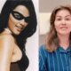 Ex Tiazinha precisara realizar enxerto apos fazer remocao no corpo
