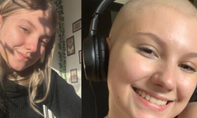 Isabel Veloso revela nova queda de cabelo na luta contra