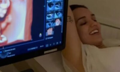 ‘Minha bebe arco iris diz Rafa Kalimann ao compartilhar ultrassom e