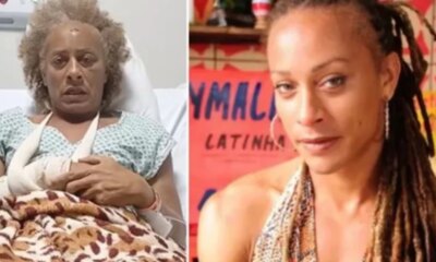 Atriz de O Pai O e brutalmente agredida pelo ex