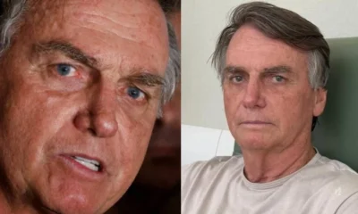 Apos ultrassom medicos apontam cirurgia para Bolsonaro afirma advogado.webp