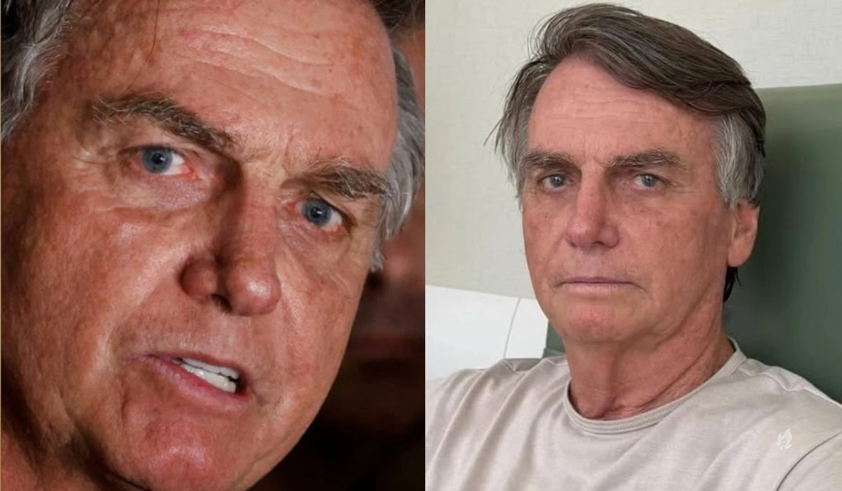 Apos ultrassom medicos apontam cirurgia para Bolsonaro afirma advogado.webp