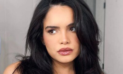 Atriz Carol Macedo sofre acidente domestico e e submetida a