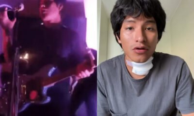 Cantor desmaia apos levar choque do proprio microfone durante show