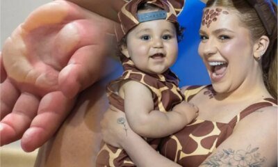 Chega noticia sobre o filho de Viih Tube apos queimadura