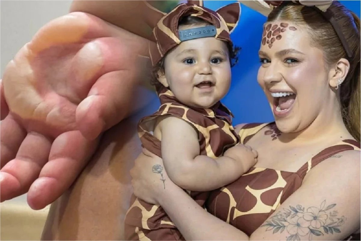 Chega noticia sobre o filho de Viih Tube apos queimadura