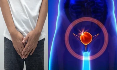 Conheca as causas e sintomas mais comuns da condicao.webp