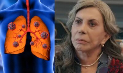 Doenca autolimitada afastou Arlete Salles as pressas da gravacao de