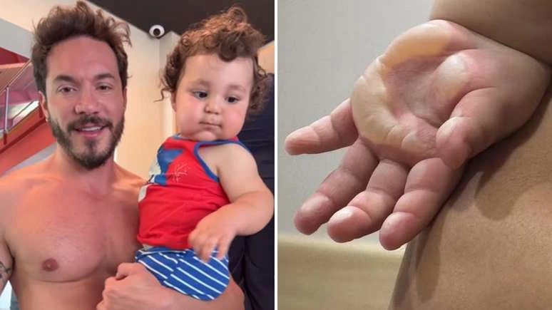 Eliezer atualiza recuperacao do filho apos cirurgia de emergencia.webp