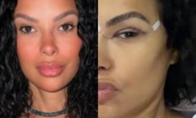 Ex BBB trans detalha cirurgia estetica e novo timbre da voz