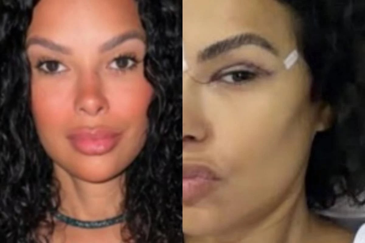 Ex BBB trans detalha cirurgia estetica e novo timbre da voz