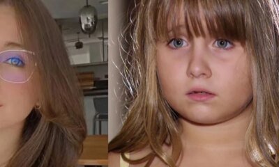 Ex atriz mirim da Globo passa por cirurgia depois de perder