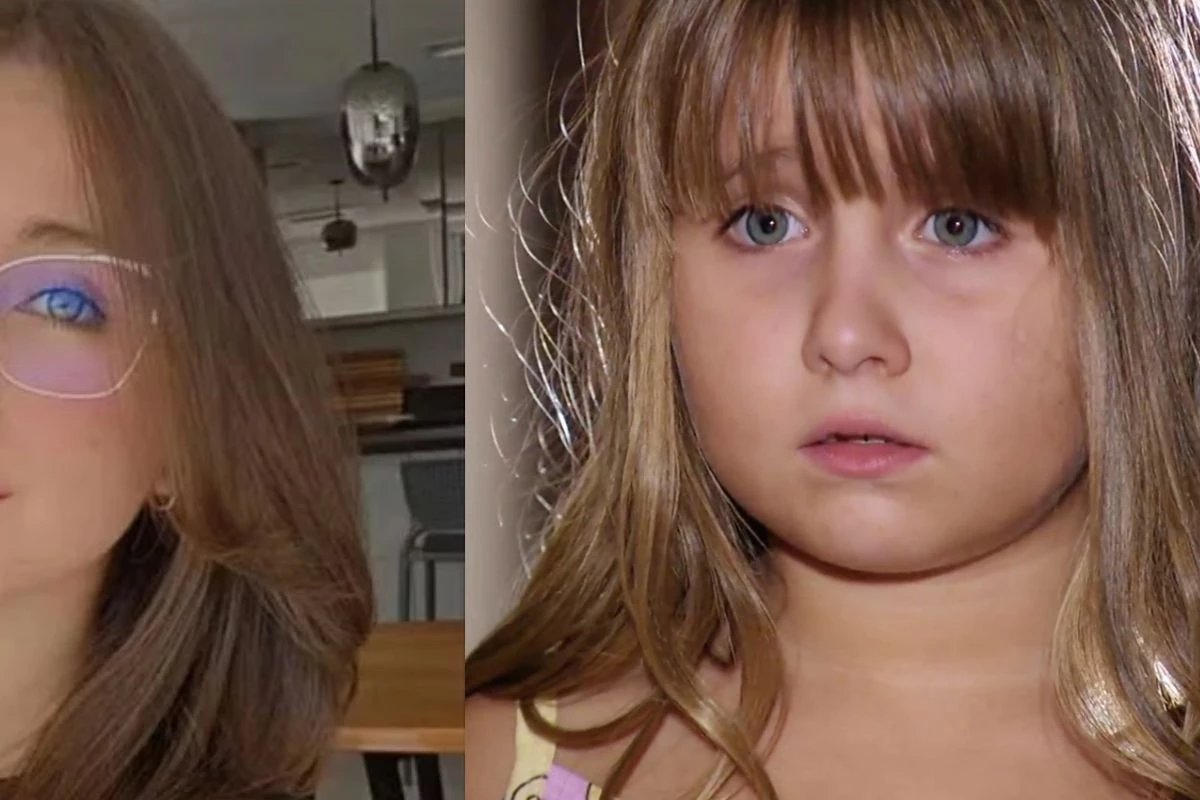 Ex atriz mirim da Globo passa por cirurgia depois de perder