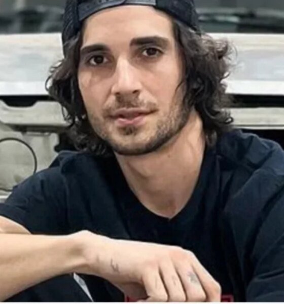 Fiuk deixa fas assustados ao aparecer com o rosto ensanguentado