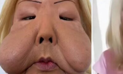 Lembra dela Juju do Pix mostra como ficou o rosto