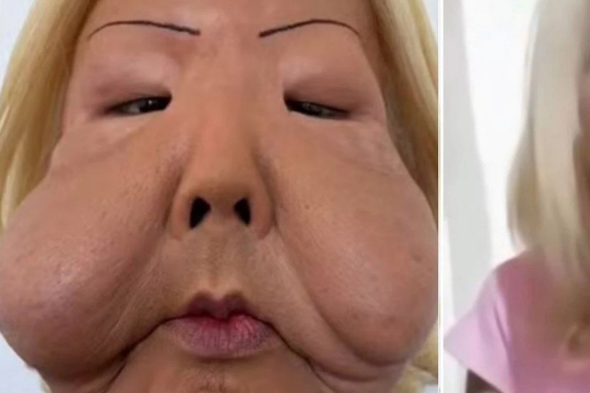 Lembra dela Juju do Pix mostra como ficou o rosto