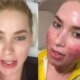 O que aconteceu com o rosto de Virginia Fonseca A