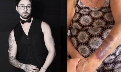 Rico Melquiades expoe marcas de agressao em familiares e desabafa