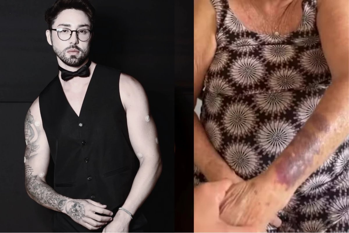 Rico Melquiades expoe marcas de agressao em familiares e desabafa