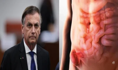 Saiba detalhes de cirurgia de hernia inguinal que sera.webp