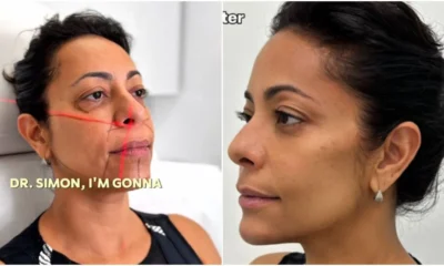 Samantha Schmutz transforma rosto com medico das Kardashians veja.webp