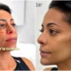 Samantha Schmutz transforma rosto com medico das Kardashians veja.webp