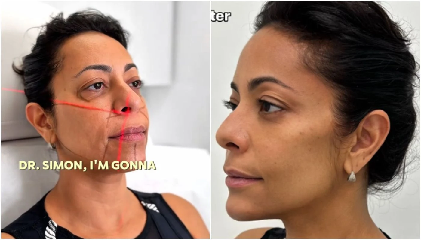 Samantha Schmutz transforma rosto com medico das Kardashians veja.webp