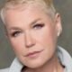 Xuxa enfrenta problema na coluna passa por cirurgia e tranquiliza