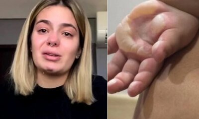 ‘Precisou internar e passar por uma cirurgia Viih Tube se