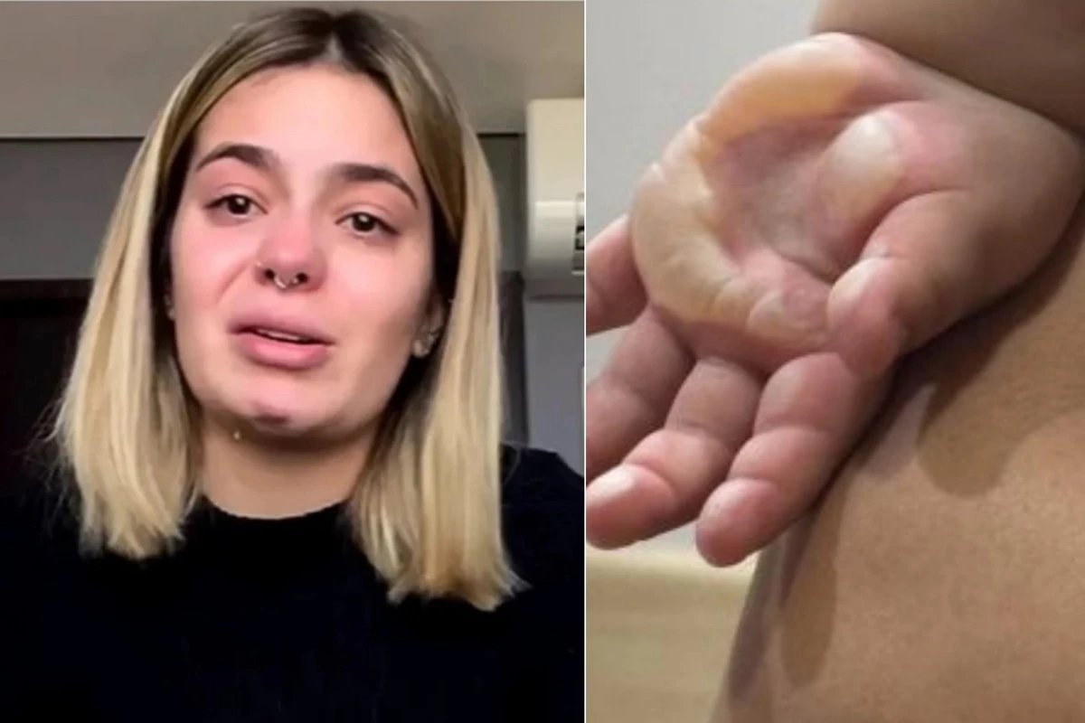 ‘Precisou internar e passar por uma cirurgia Viih Tube se