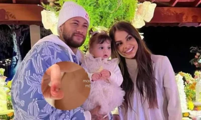 Apos fratura exposta em grave acidente Amanda Kimberlly mostra.webp