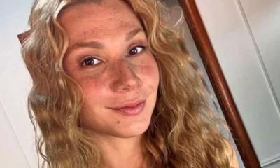 Atriz de 32 anos detalha recuperacao apos sofrer AVC.webp