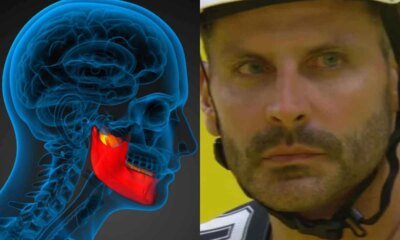 Esses sao os sintomas que Henri Castelli enfrenta apos sofrer