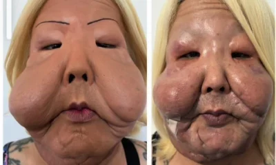 Juju do Pix passa por pequena cirurgia apos 1a.webp