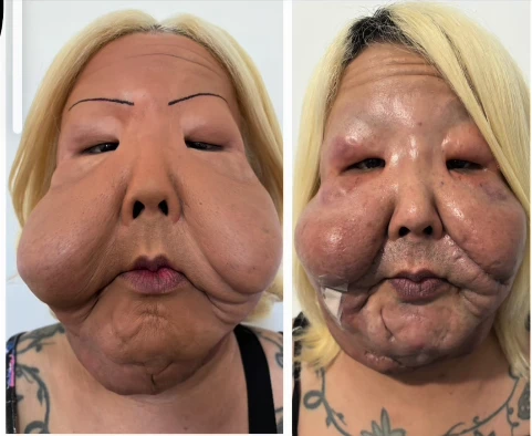 Juju do Pix passa por pequena cirurgia apos 1a.webp