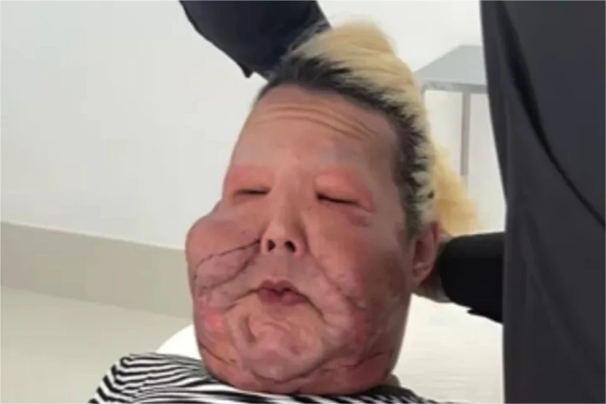 Juju do Pix volta a ser internada e passara por