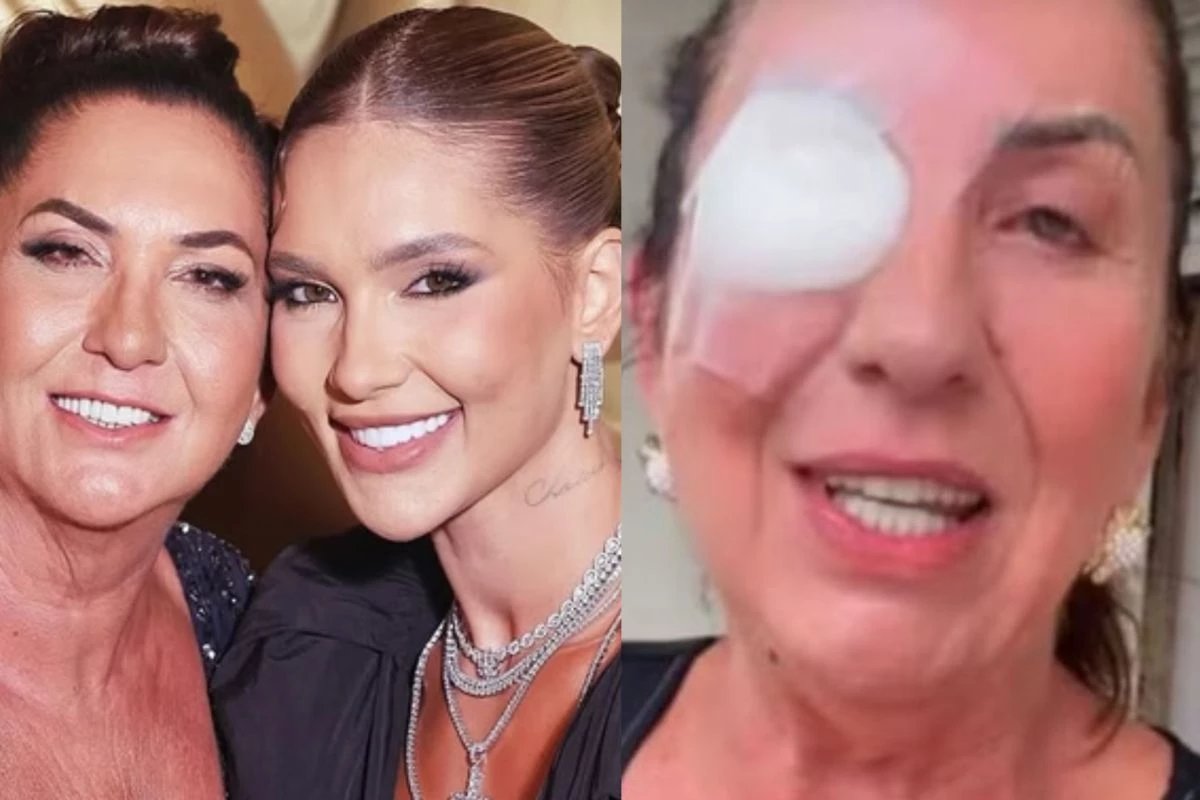Mae de Virginia Fonseca surge com curativo e conta o