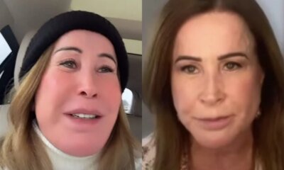 Medicos tomam decisao sobre cirurgia em face de Zilu Godoi