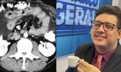 O que e quais sintomas da doenca que tirou a