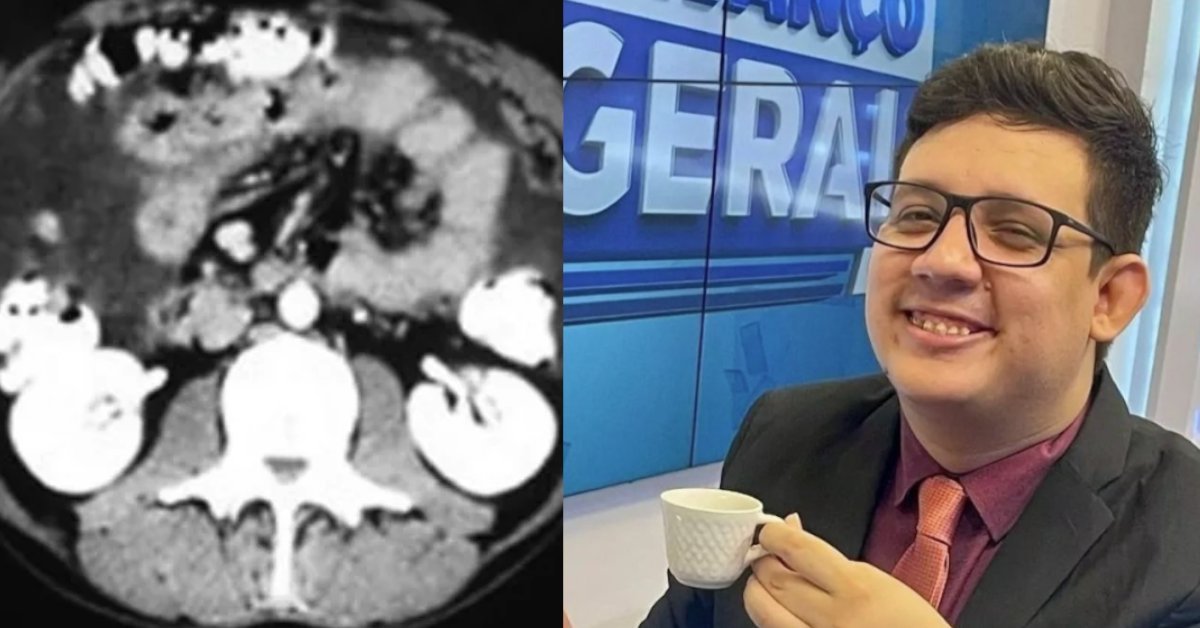 O que e quais sintomas da doenca que tirou a