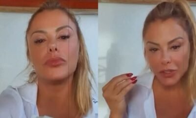 Poliana Rocha exibe hematoma resultado do drama vivido pela mae