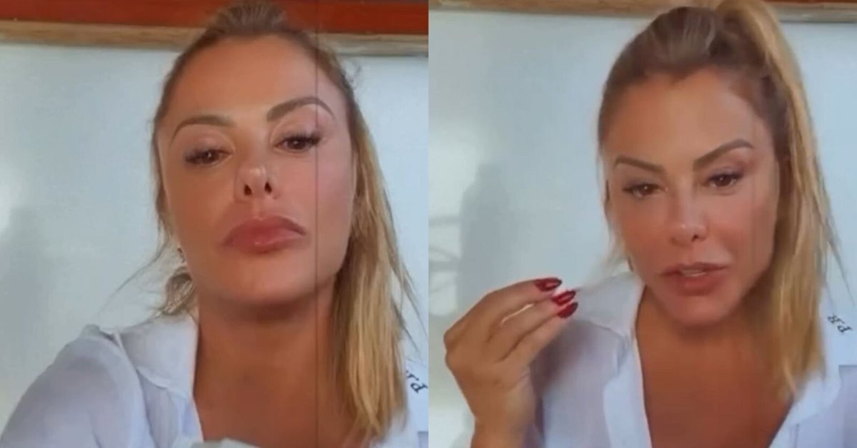 Poliana Rocha exibe hematoma resultado do drama vivido pela mae