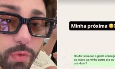 Rico Melquiades cogita cirurgia para diminuir a altura Serrar os